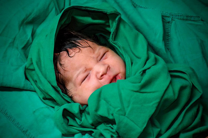 0 29 neonatologia